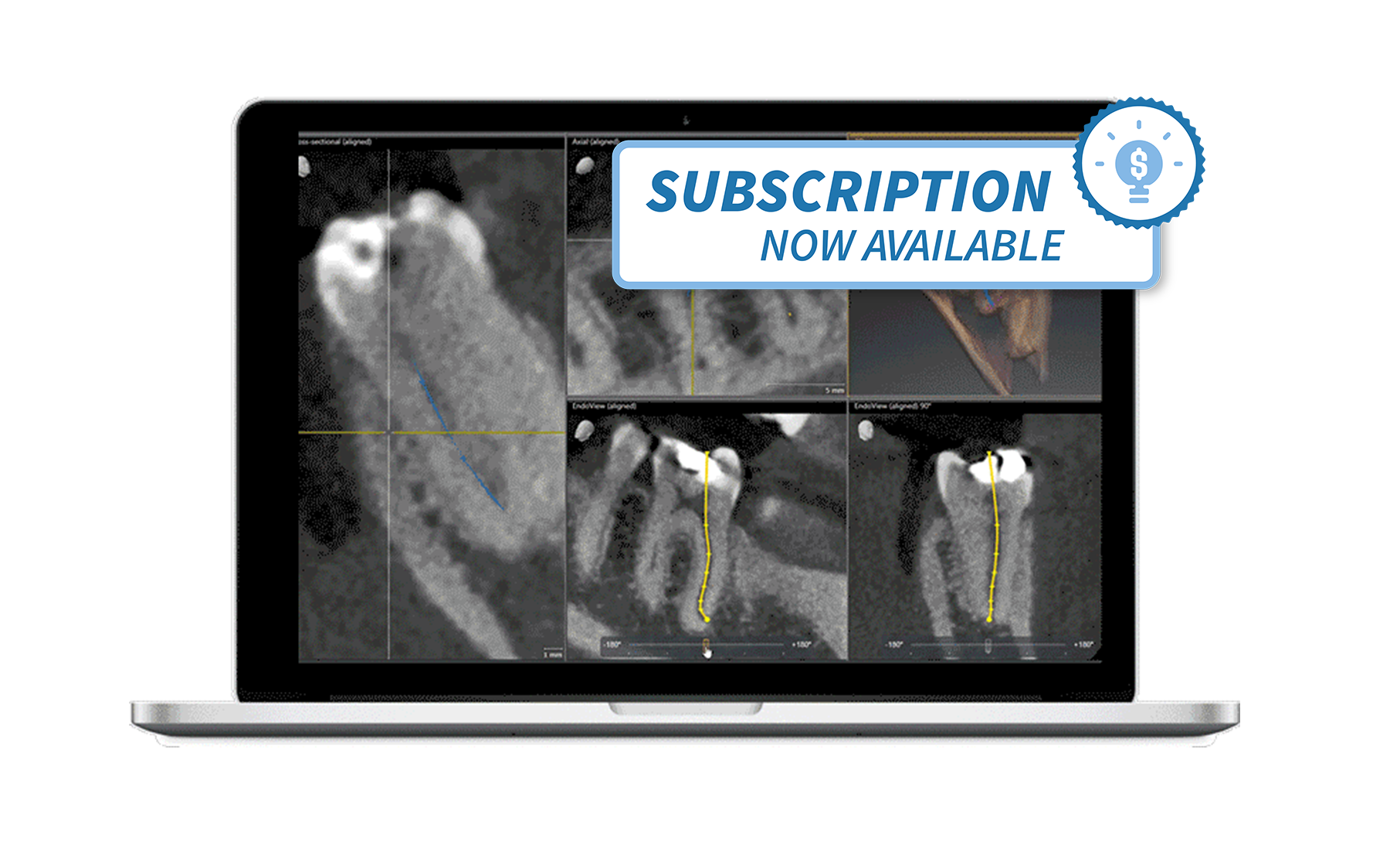 products_endodontie_img_badge_en